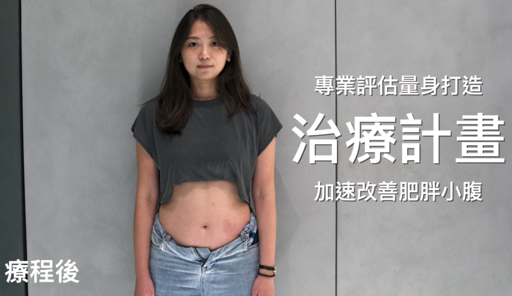 改善小腹線條後輕鬆穿上牛仔褲的體態管理見證