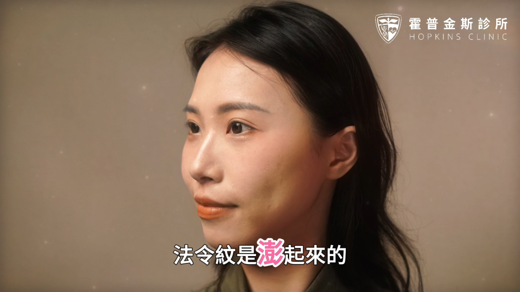 教育工作者接受 EMFACE 菲斯波改善淚溝與法令紋