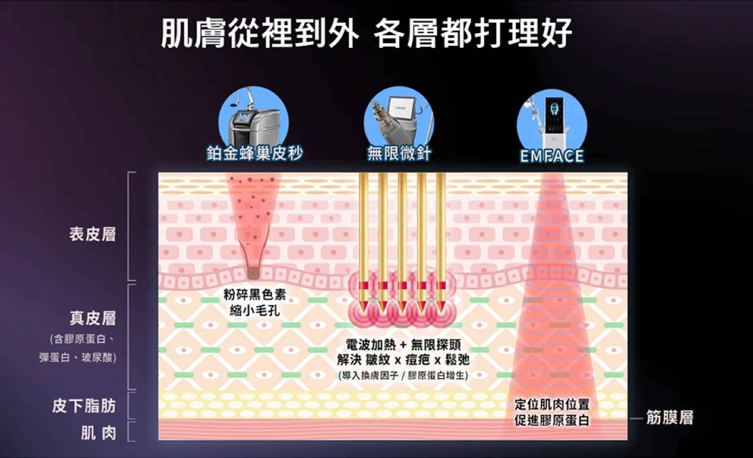 無限電波微針 | Hopkins