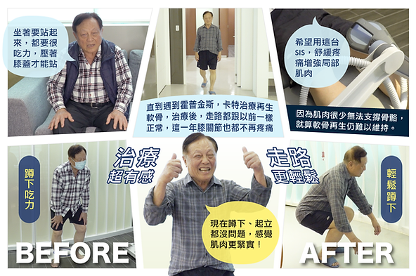 【影片見證】Yoke 先生 / 卡特+SIS治療 遠離退化性關節炎 1 00fa87 0e83459a4806443c889c7ce3bfe0ae4emv2