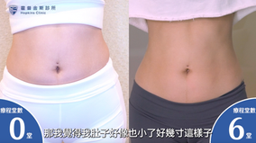 【影片見證】顏言小姐 / 雙機多效 拯救產後媽媽鬆弛肚 5 肚子小了好幾吋