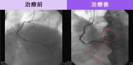 Alma Duo野馬波評價如何?這項治療技術真的有效嗎?來看專家和患者怎麼說! 4 許多接受過Alma Duo野馬波治療的患者報告稱,他們在治療後的性生活質量顯著提高。