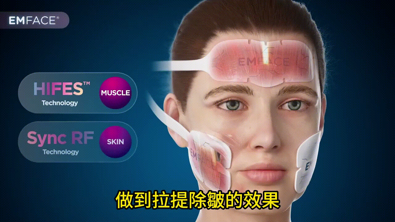 無痛拉提新時代——霍普金斯診所全新的Emface 2 EMface是一種革命性的臉部提升儀器,結合了高強度電磁刺激(HIFES)和同步射頻(RF)技術。這兩種技術的完美結合