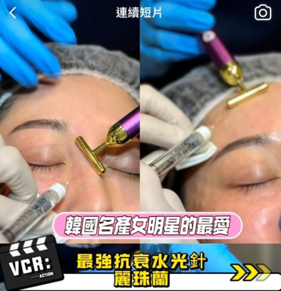 麗珠蘭是什麼?韓國熱門肌膚修復療程全解析! 1 因具有極佳的肌膚修復和再生功效,由於其能夠刺激膠原蛋白增生、改善肌膚彈性、細紋和膚質,因此成為近年來醫美界的熱門選擇。
