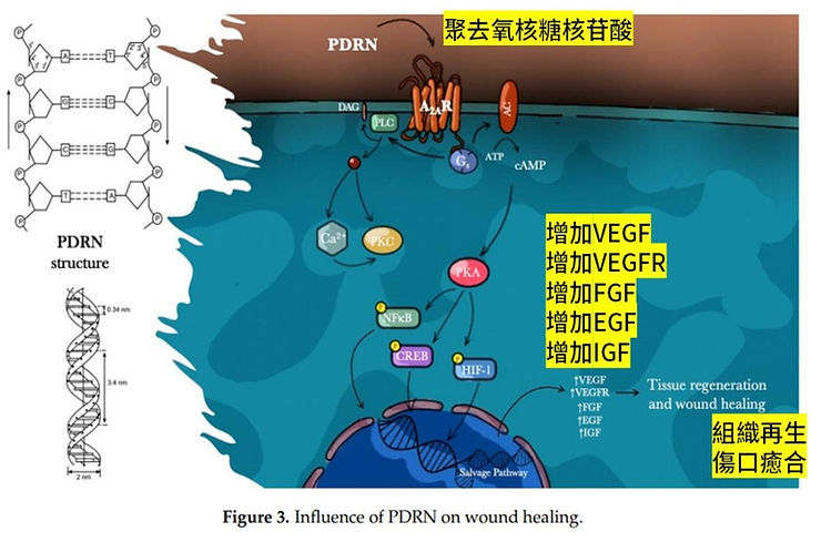 麗珠蘭的主要成分PDRN是什麼?醫學研究告訴你它的作用 1 PDRN(Polydeoxyribonucleotide,聚去氧核糖核苷酸)是一種來自鮭魚DNA的生物活性物質