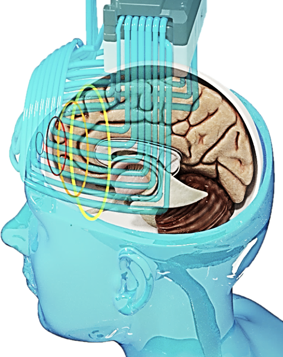 DeepTMS(深層經顱磁刺激)在強迫症治療上的應用:帶來新契機 4 根據多項臨床試驗,DeepTMS(深層經顱磁刺激)在改善強迫症狀方面,取得與憂鬱症相似的正面成績,尤其是對傳統藥物治療效果不佳或副作用高的病患,