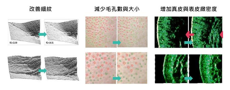 麗珠蘭是什麼?韓國熱門肌膚修復療程全解析! 2 PDRN成分能有效修復受損細胞,提高肌膚自我修復能力。
