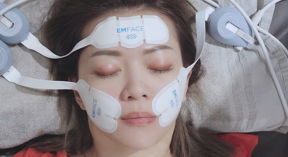Emface菲斯波懶人包:從原理、價格到術後保養,一次搞懂最新非侵入式拉提 8 心得:第 2~3 次主要感受臉部緊繃,完成第 5~6 次後,下顎線更明顯,法令紋淡化。整體臉部更有精神。