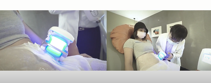 【影片見證】彧彣 / 專業營養師搭配冷凍減脂 1 e1460d bca66a06b4f54e7692f14886a03ce9f0mv2