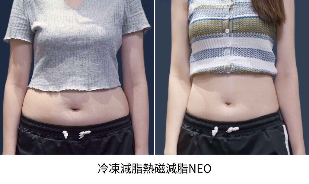 站用圖 159