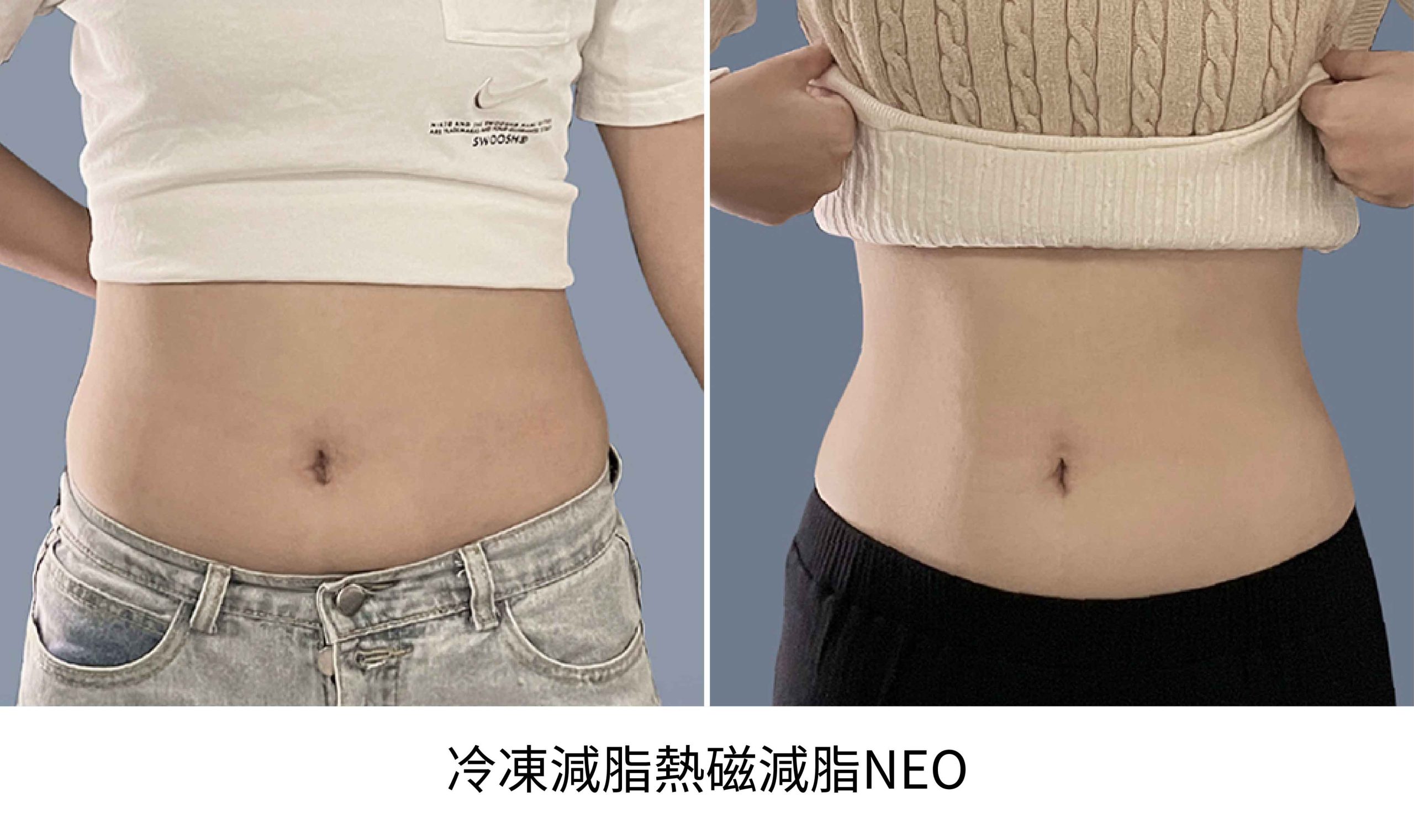 neo BA