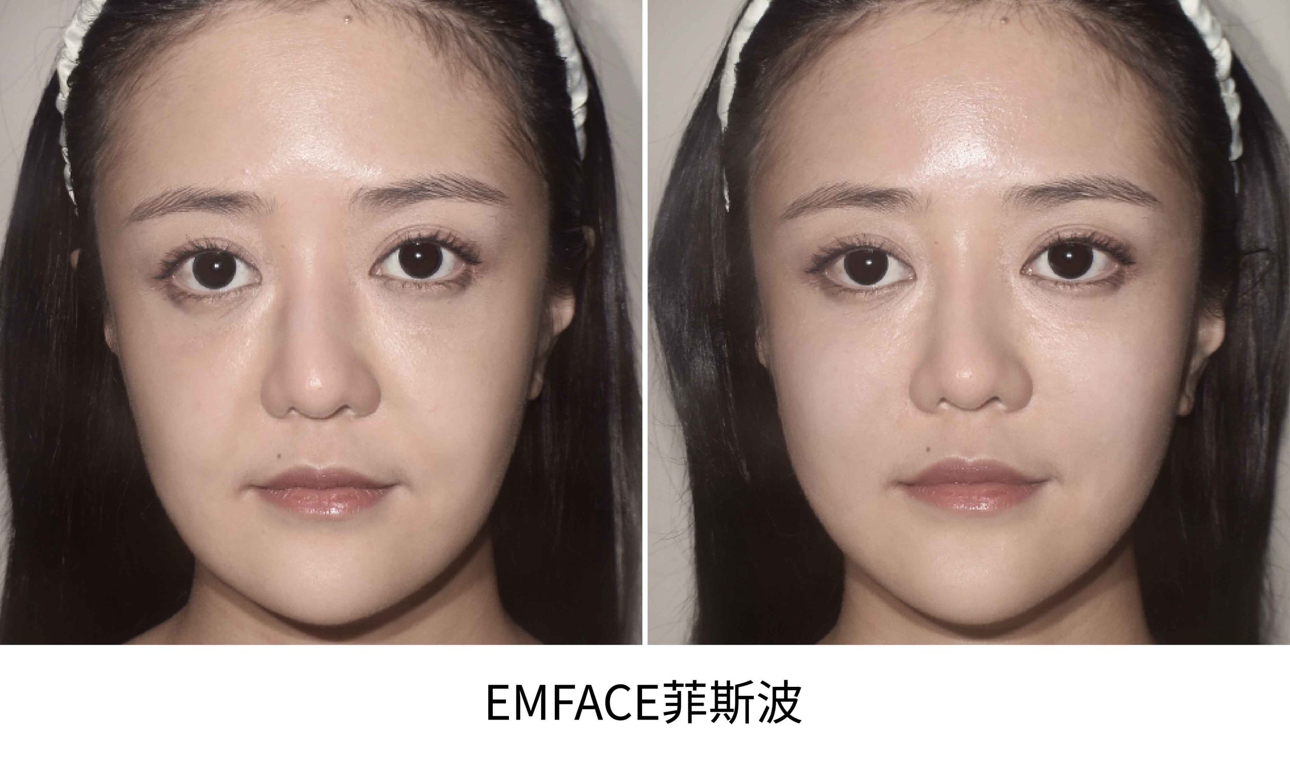 emface BA