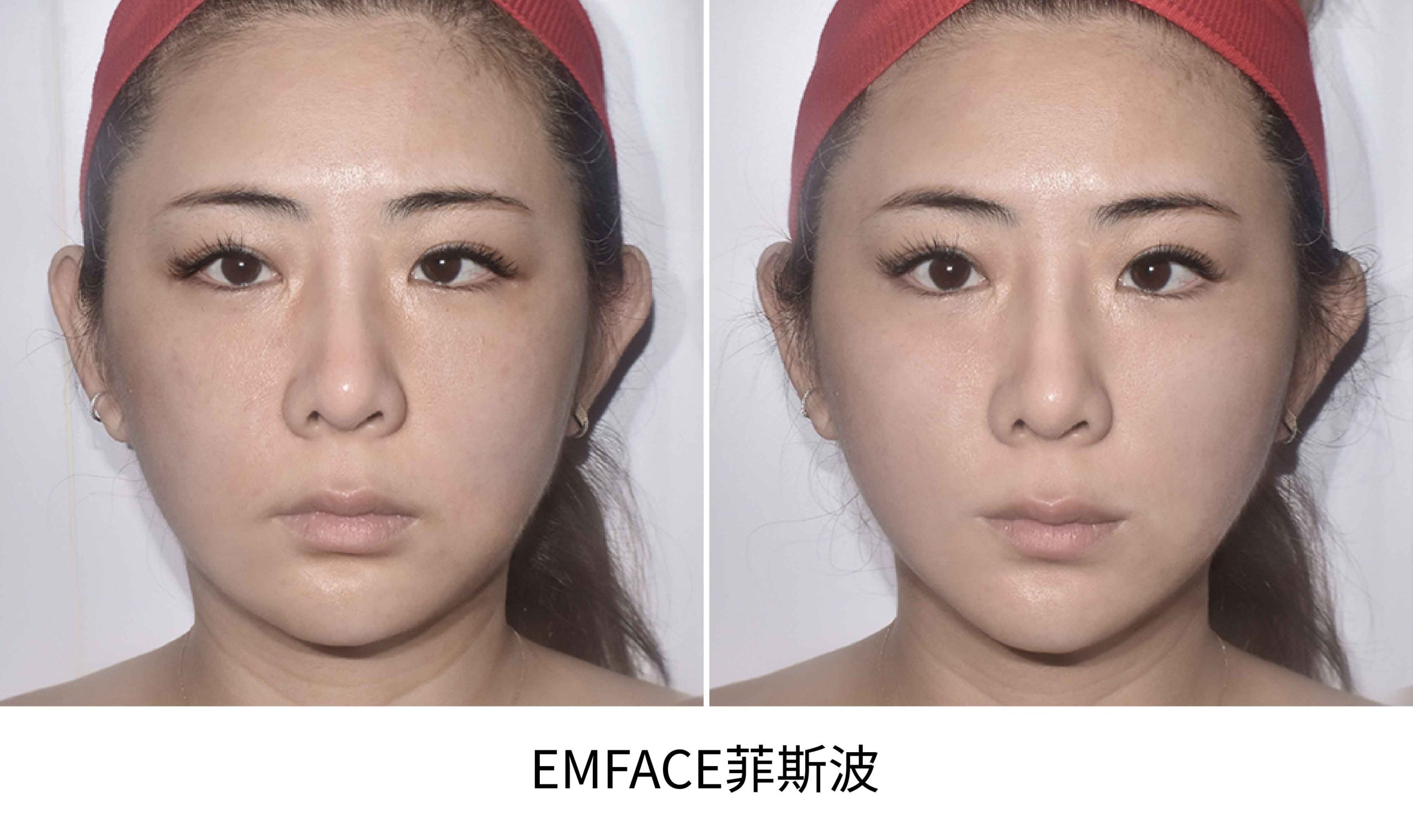 emface BA