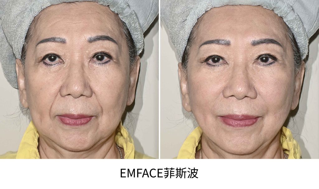 站用圖 22