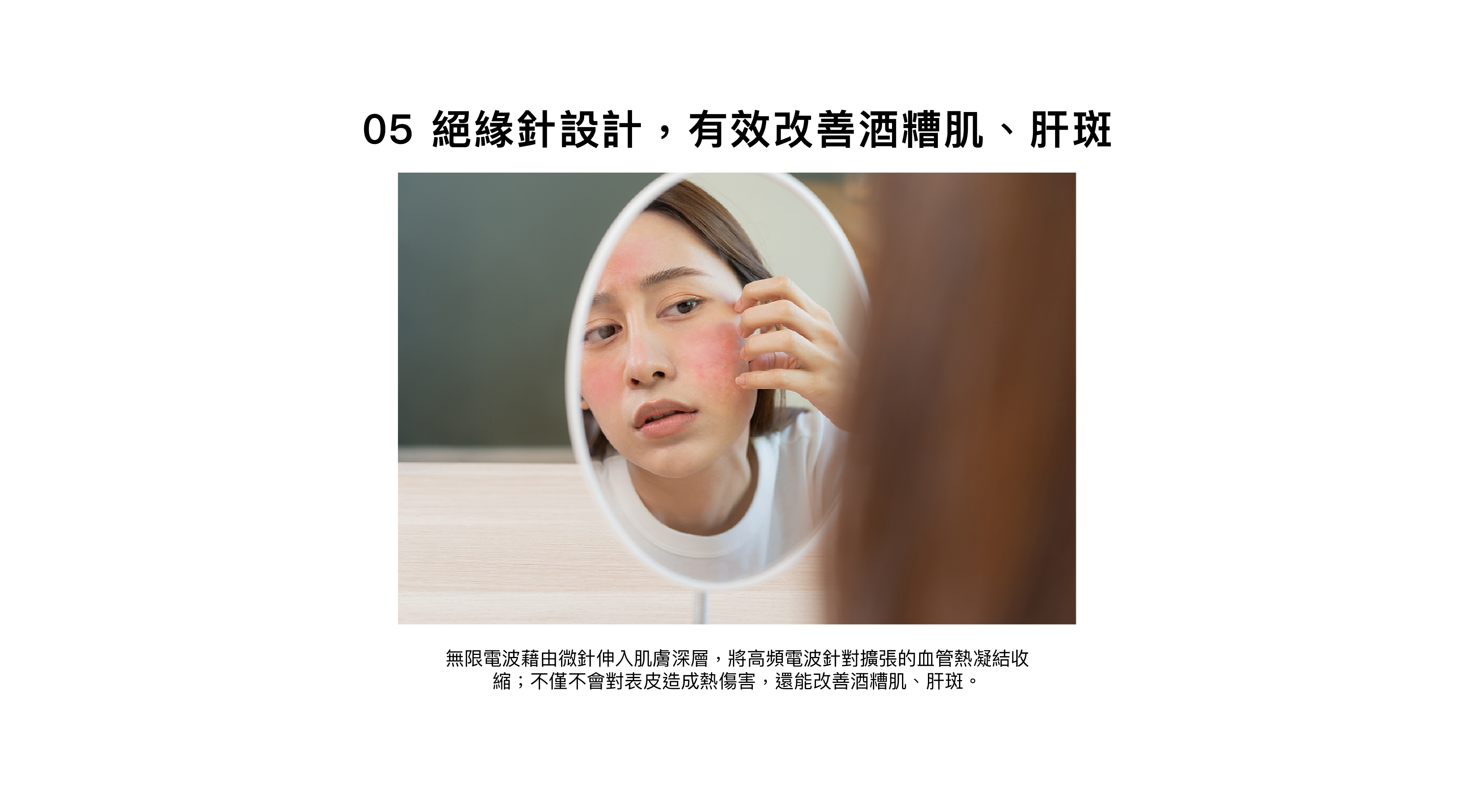 絕緣針設計，有效改善酒糟肌、汗斑