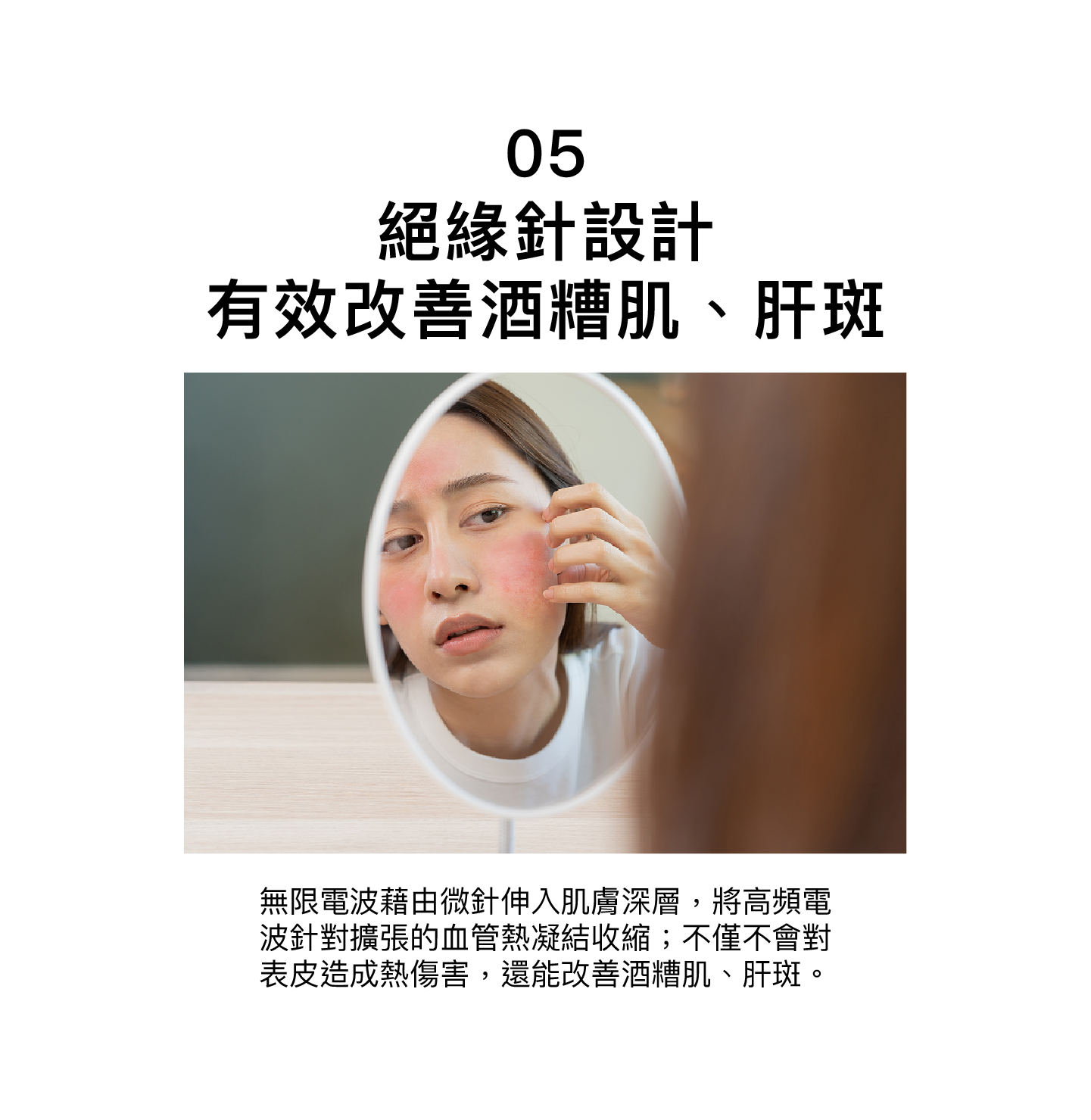 絕緣針設計，有效改善酒糟肌、汗斑