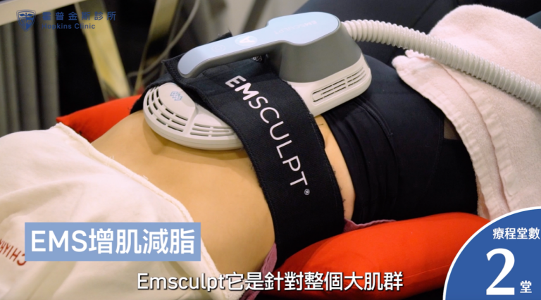 產後媽咪施作體雕後腹部線條改善