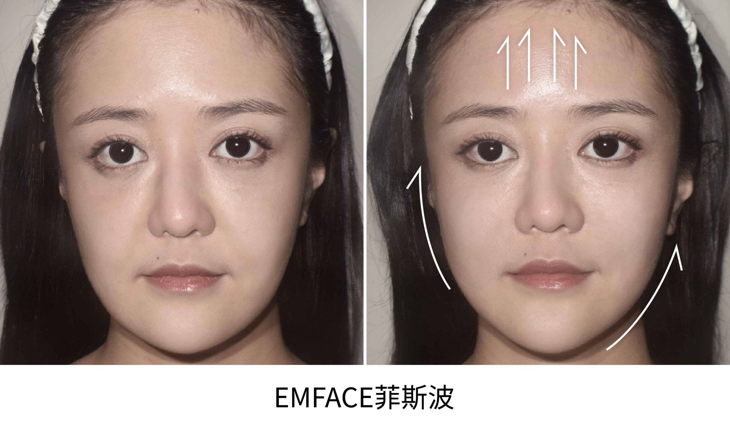 emface BA