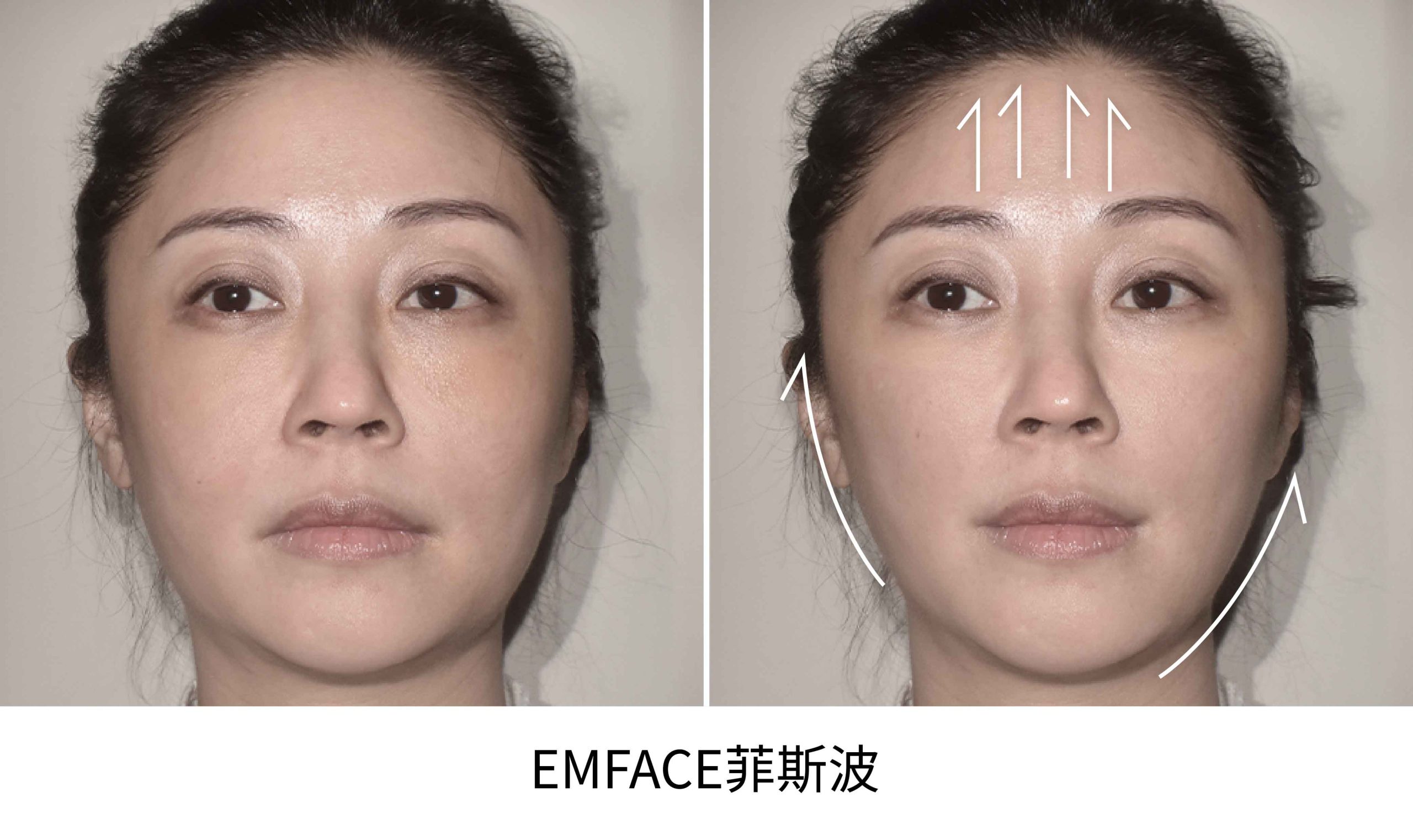 emface BA