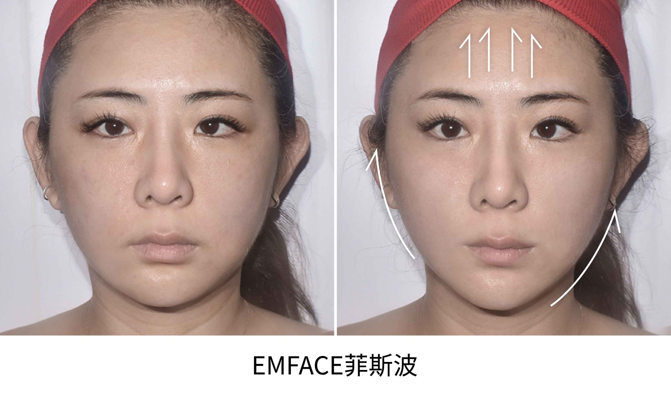 emface BA