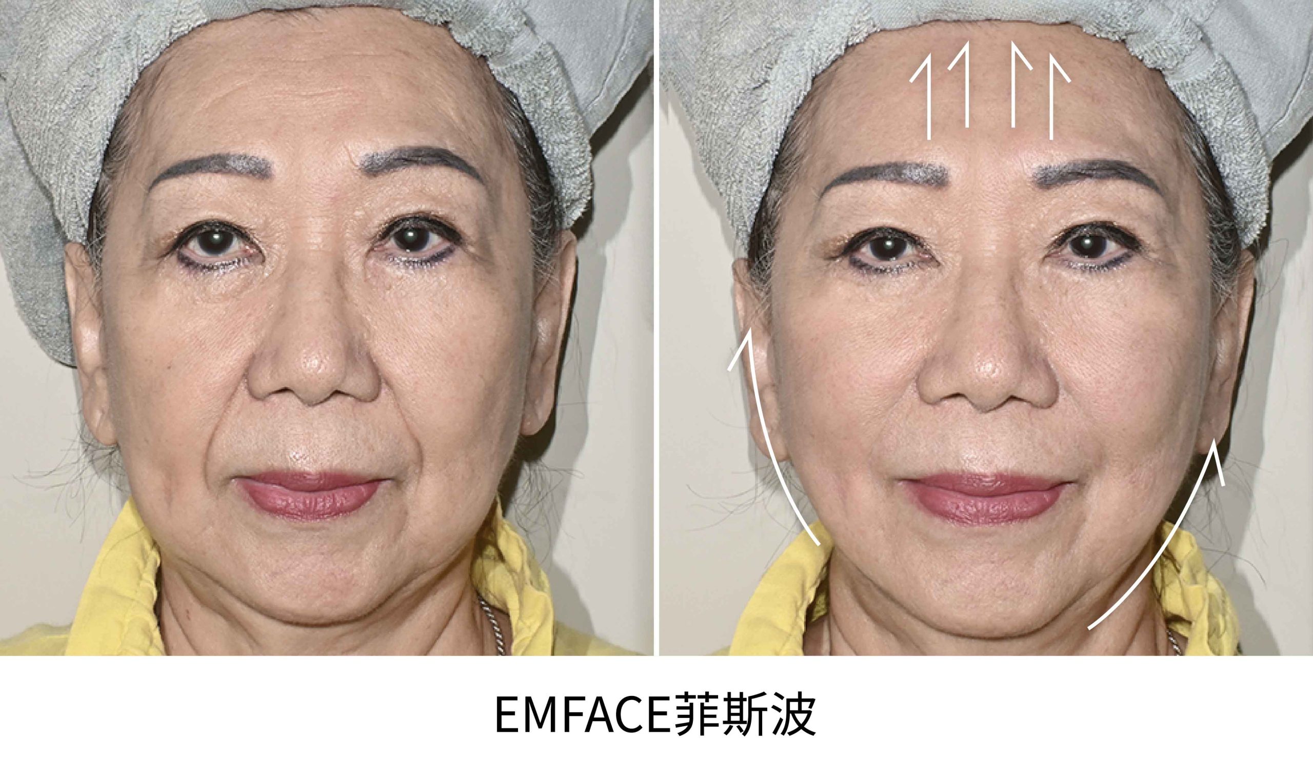 emface BA
