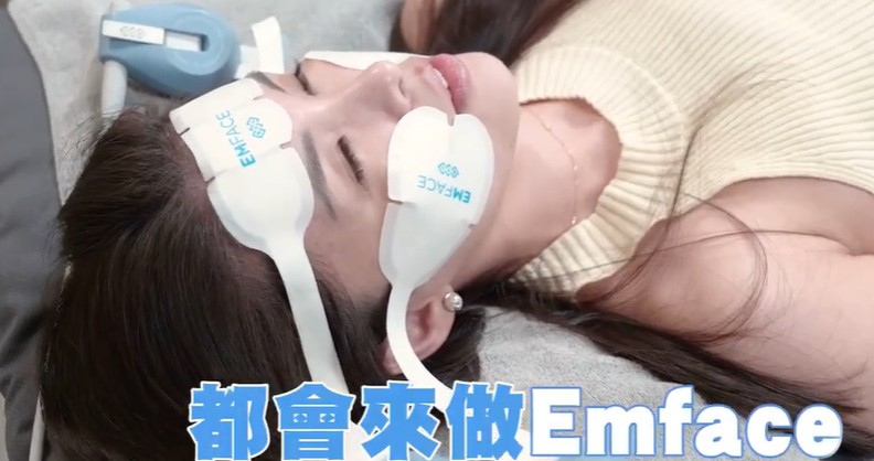 EMFACE 菲斯波施作後顯示臉部緊緻與支撐感提升的效果