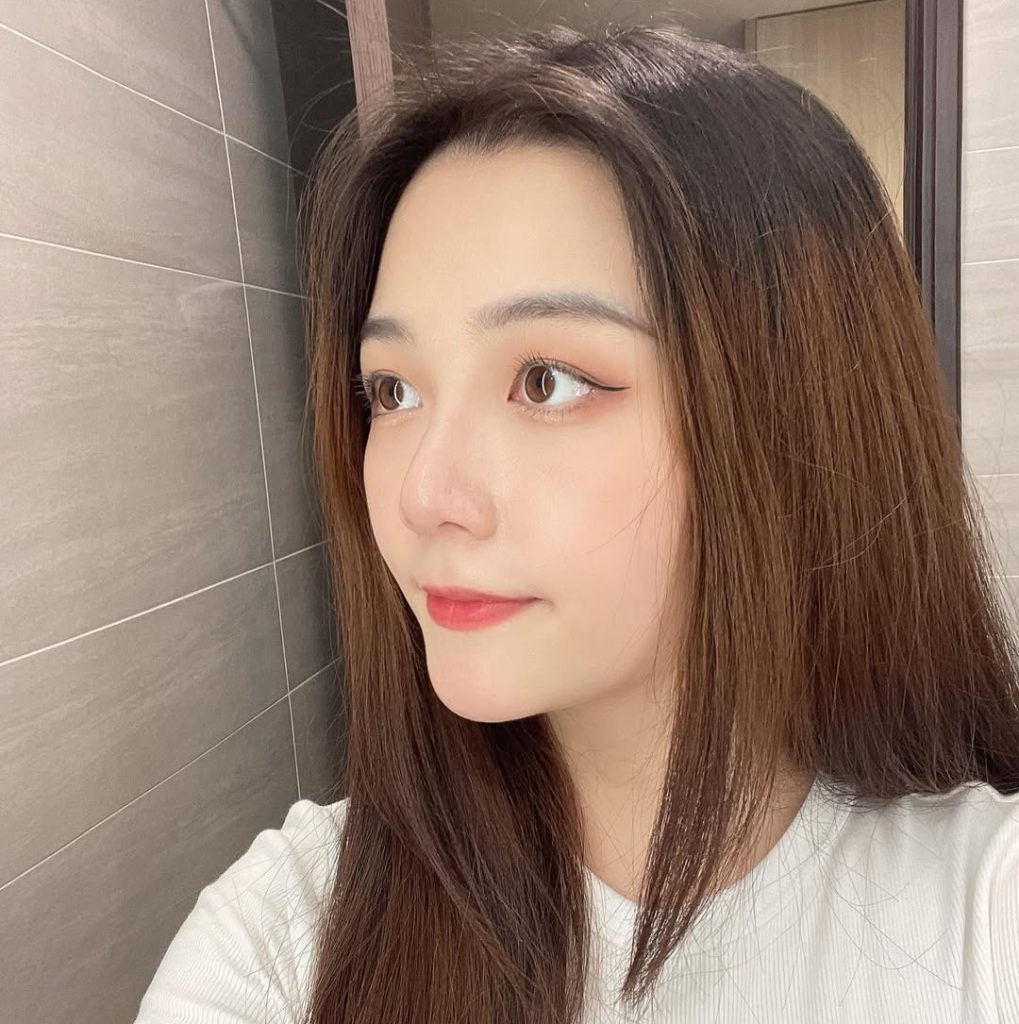 無限電波術後肌膚緊緻與毛孔改善的療程見證照