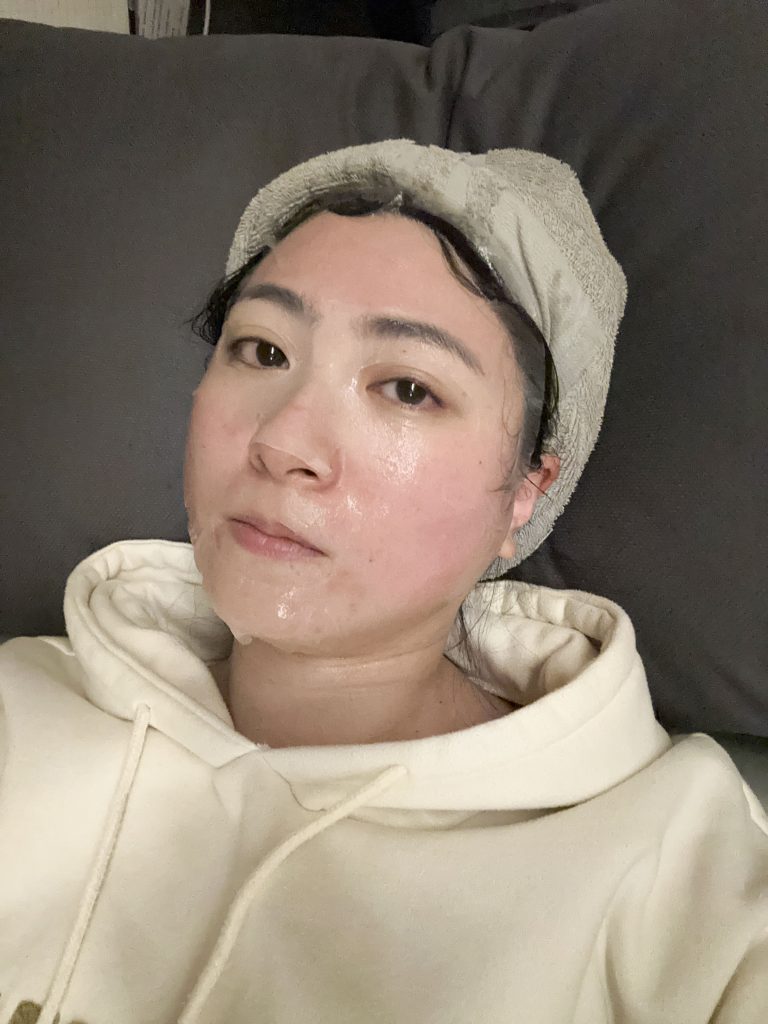 EMFACE菲斯波非侵入式臉部肌肉拉提療程與3D影像術後對比分析