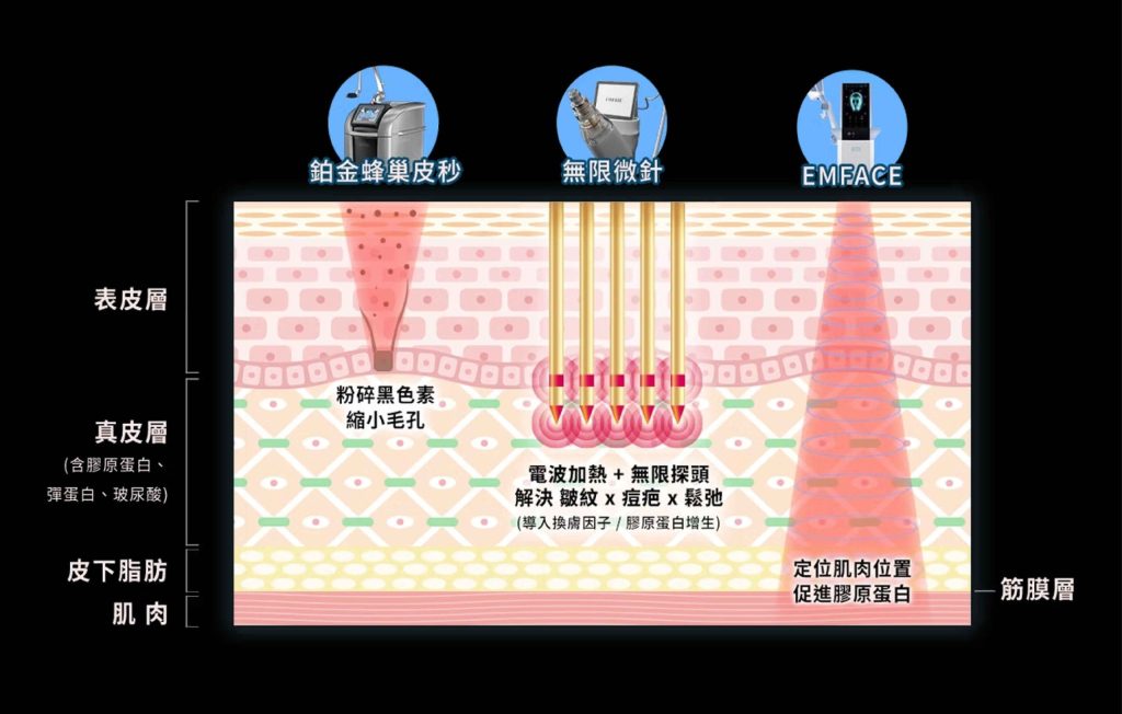 三大醫美療程作用深度比較圖-鉑金蜂巢皮秒和無限電波微針與EMFACE菲斯波的層次解析