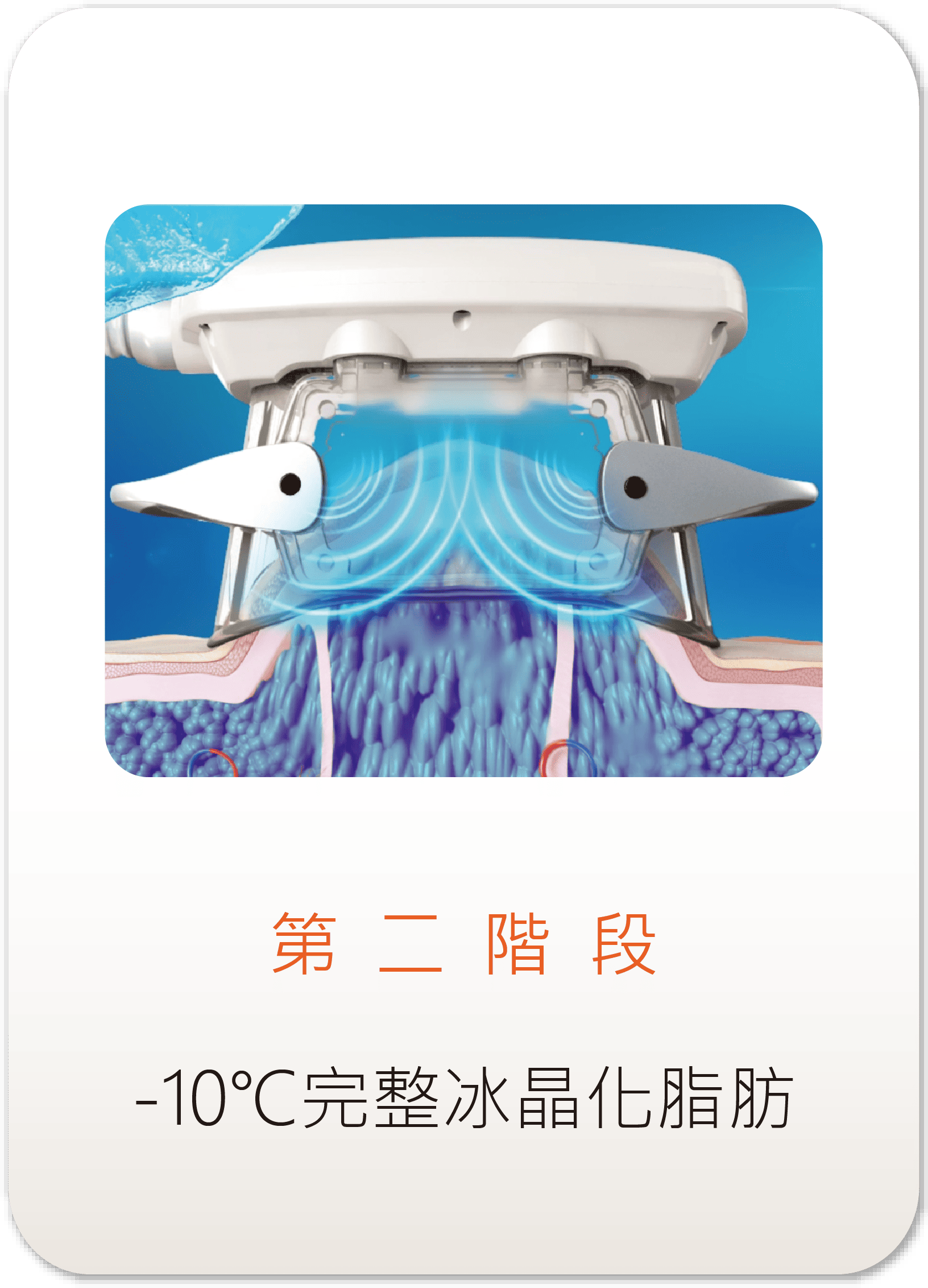 ZLipo Z塑酷冷凍減脂第二階段示意圖-負10度C極致凍結脂肪細胞與冰晶化效應