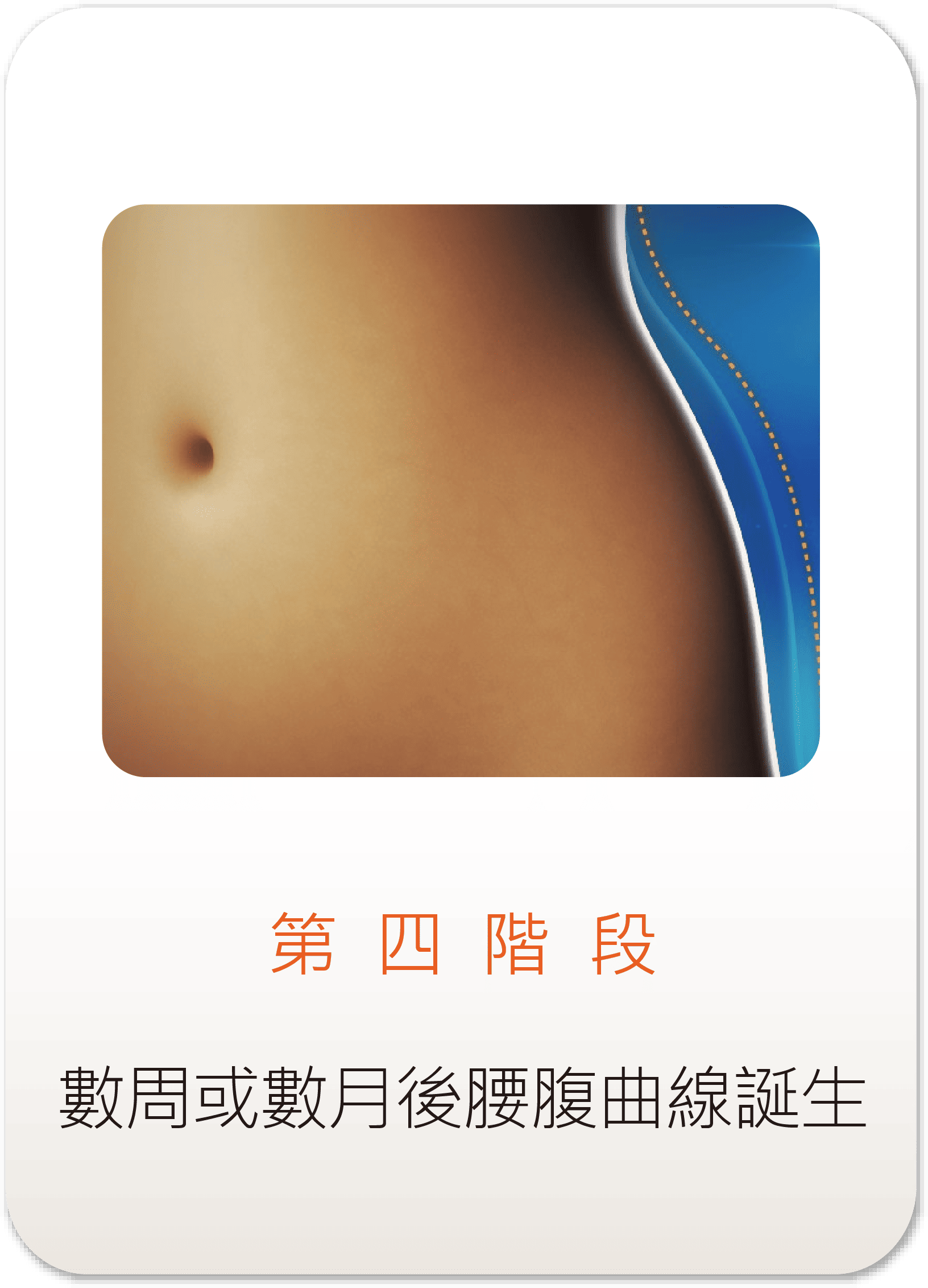 ZLipo Z塑酷冷凍減脂第四階段示意圖-術後數週展現腰腹纖細曲線與減脂成效