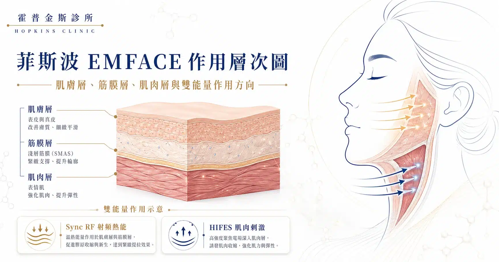 菲斯波HIFES與Sync RF雙能量作用原理示意圖