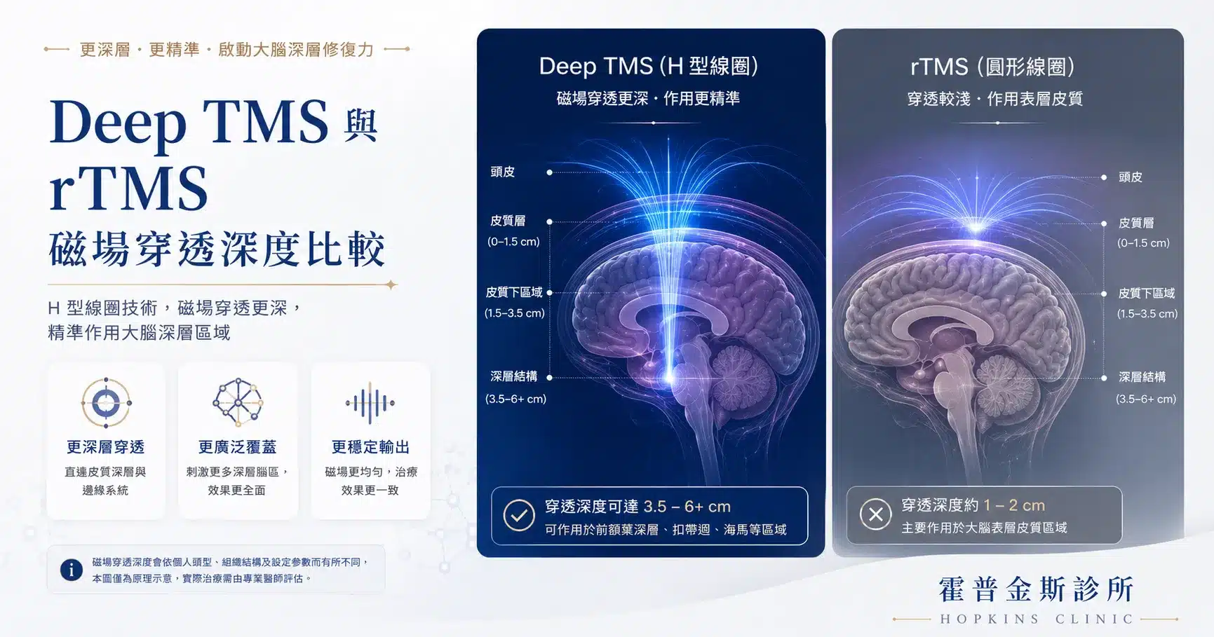 Deep TMS H 型線圈與傳統 rTMS 磁場穿透深度對比圖