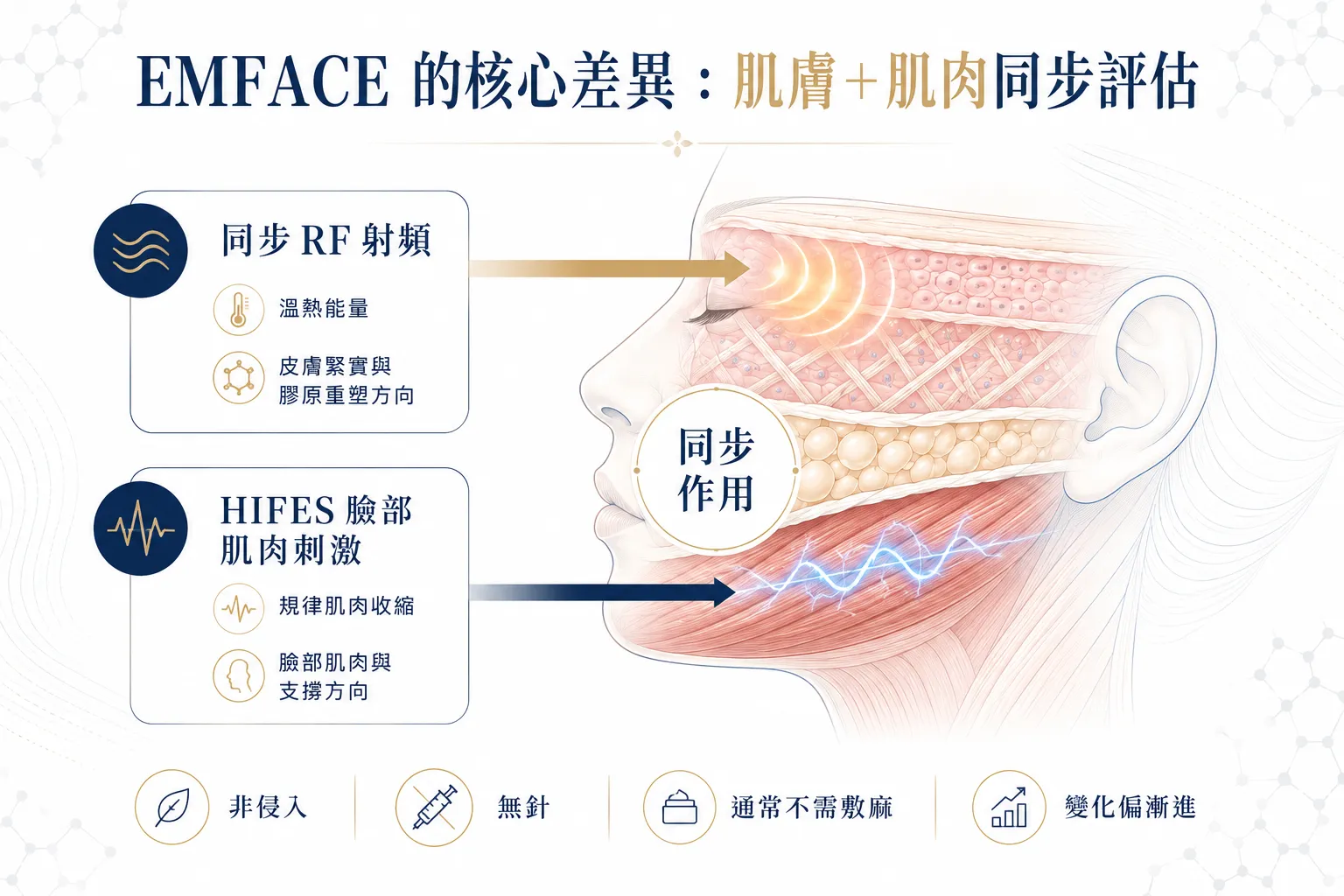 竹北醫美推薦怎麼選?2026 怕痛、怕麻醉、怕不自然的 6 大拉提療程比較 4 EMFACE 菲斯波結合同步 RF 射頻與 HIFES 臉部肌肉刺激的作用概念示意