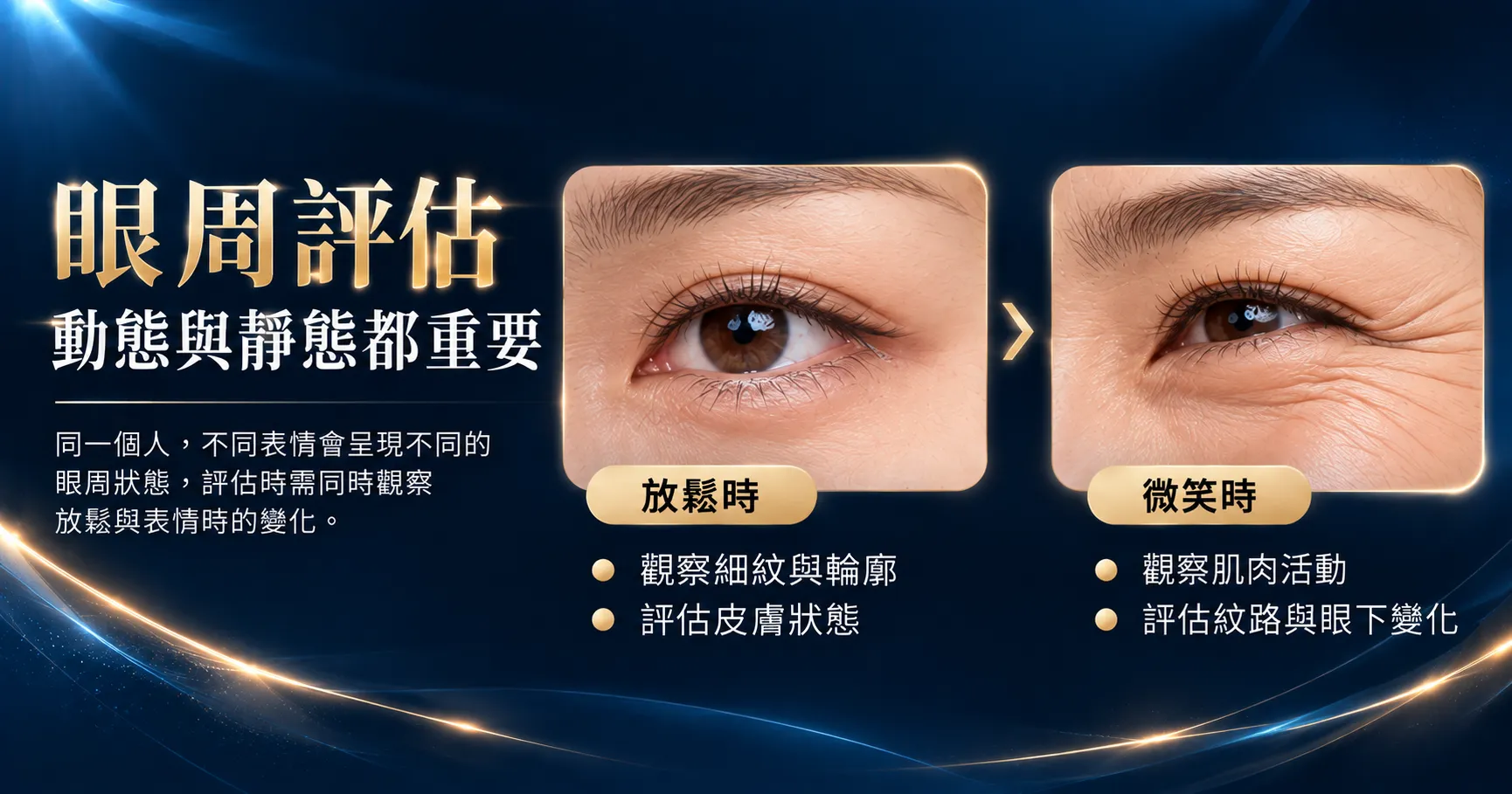 EMFACE 眼周貼片是什麼?魚尾紋、眼袋、淚溝與療程安排一次了解 4 眼周魚尾紋動態與靜態評估圖解,比較放鬆及微笑時的眼尾細紋與肌肉活動變化,協助了解EMFACE眼周療程前的評估重點。